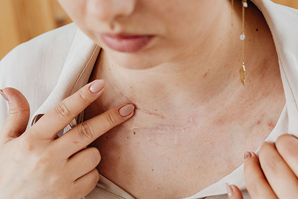 Understanding Sensitive Skin